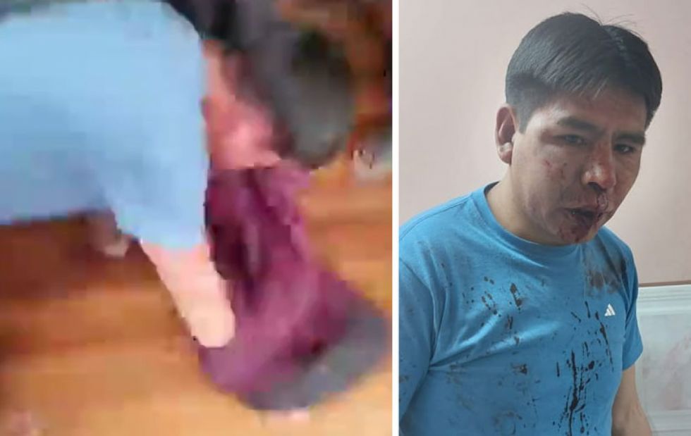 Agreden a diputado hasta dejarlo ensangrentado y éste acusa a enviados de Evo Morales (Video)