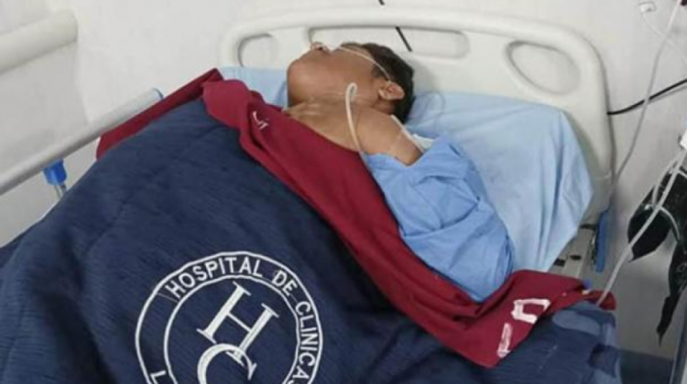 Empeora estado de salud de César Apaza por falta de fisioterapia, denuncian familiares