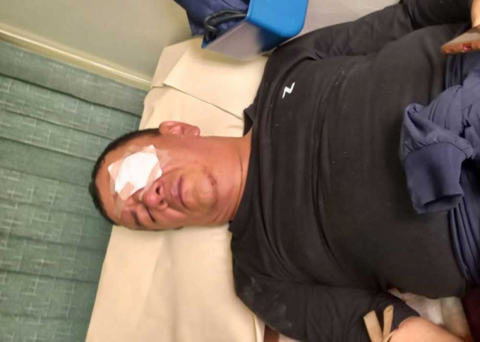 Denuncian que un profesor fue herido en un ojo tras el impacto de un balín disparado por la Policía