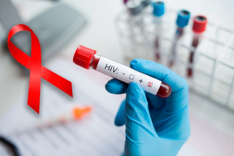 Chuquisaca ingresa en zona de epidemia debido al aumento en casos de VIH-Sida y la tasa de mortalidad
