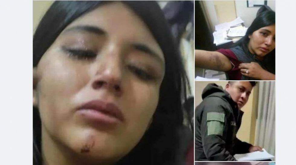 Mujer denuncia violencia y recurre a sus redes sociales ante inacción de autoridades