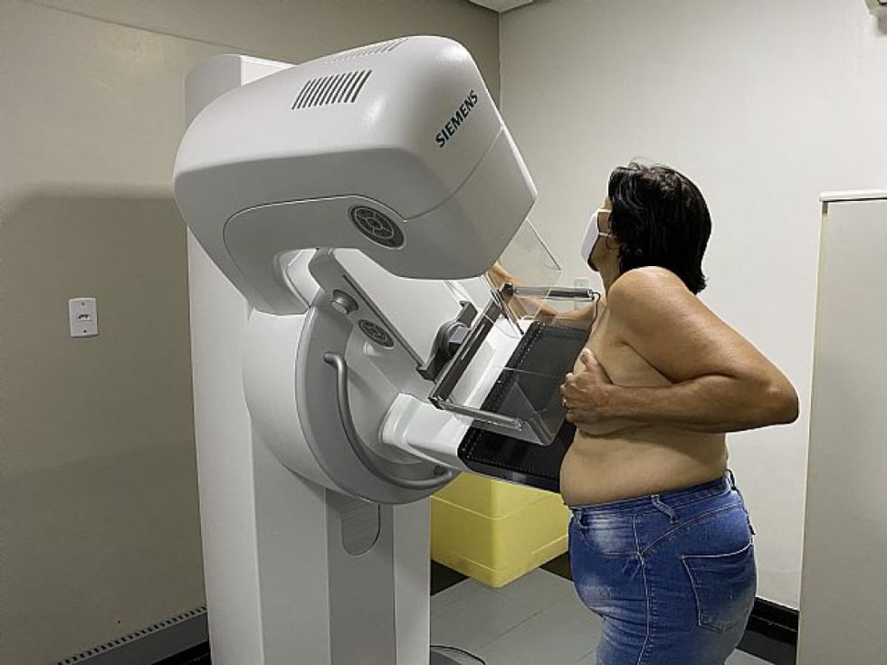 En 10 meses, Tarija registró 119 casos de cáncer de mama