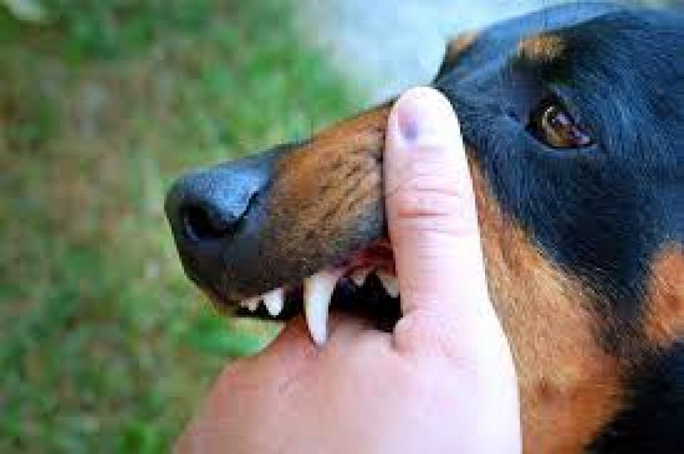 Niña sufre grave mordedura en el rostro por un perro en Tarija