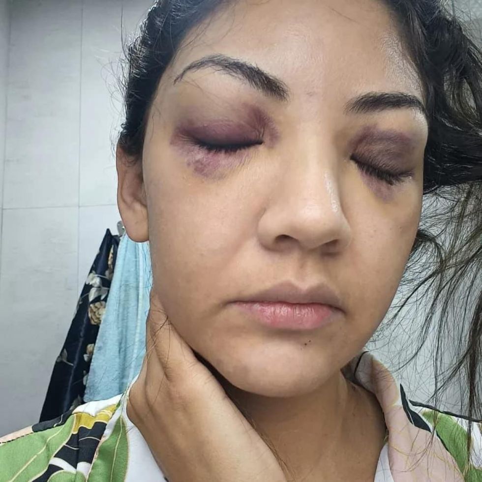La víctima publicó fotografías de su agresión