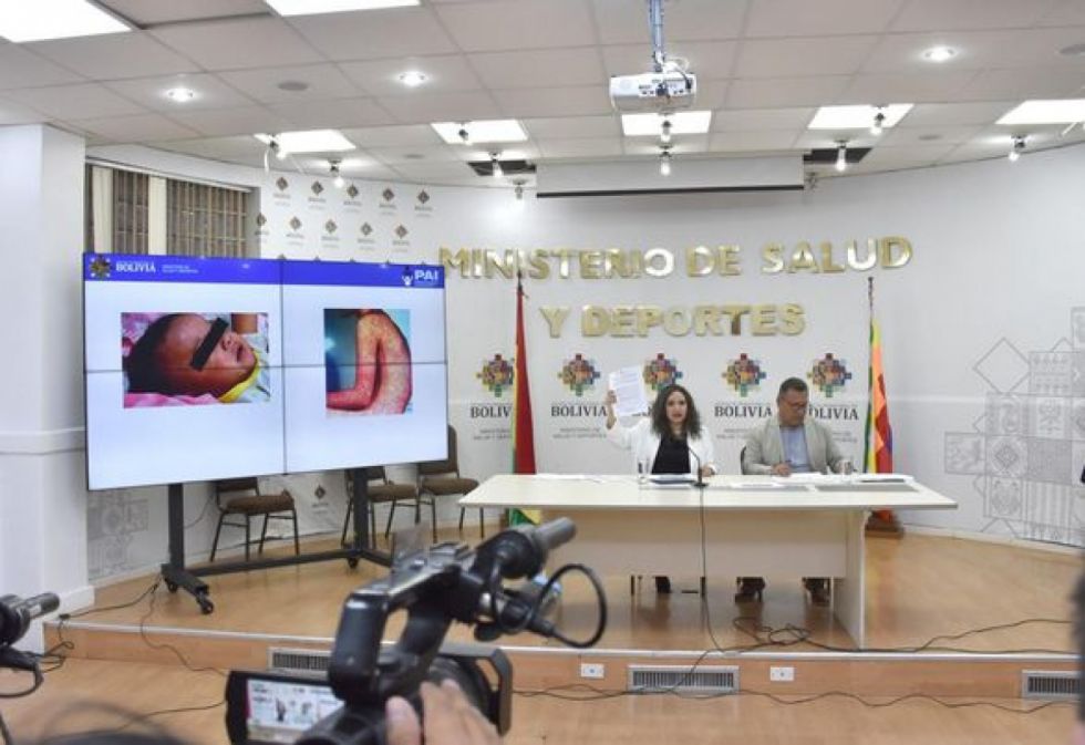 Salud se moviliza ante nuevo caso de sarampión en Bolivia