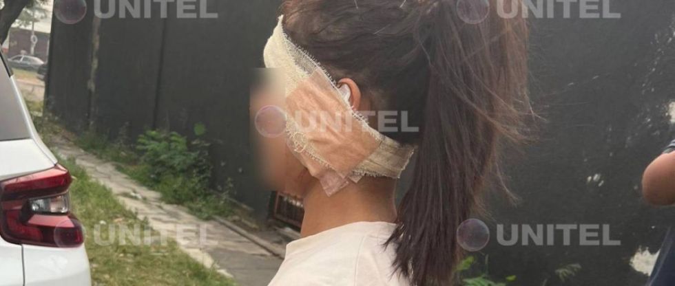 Una mujer denuncia a su pareja por arrancarle parte de su oreja por pasajes para ver el partido Bolivia vs Colombia