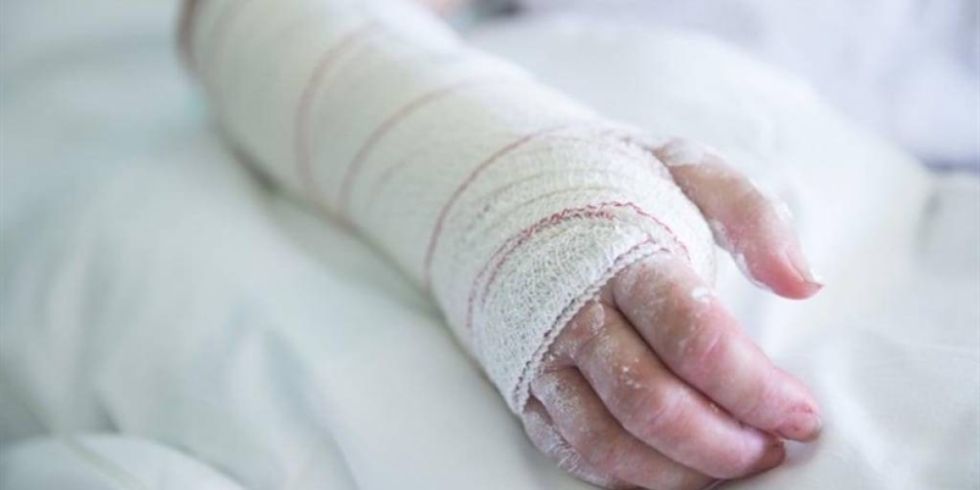 Sujeto le prende fuego a su pareja y ella se niega a denunciarlo