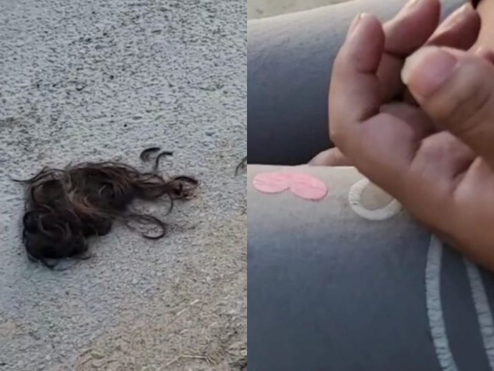 Tarija: Reportan agresión de una Policía contra otra mujer