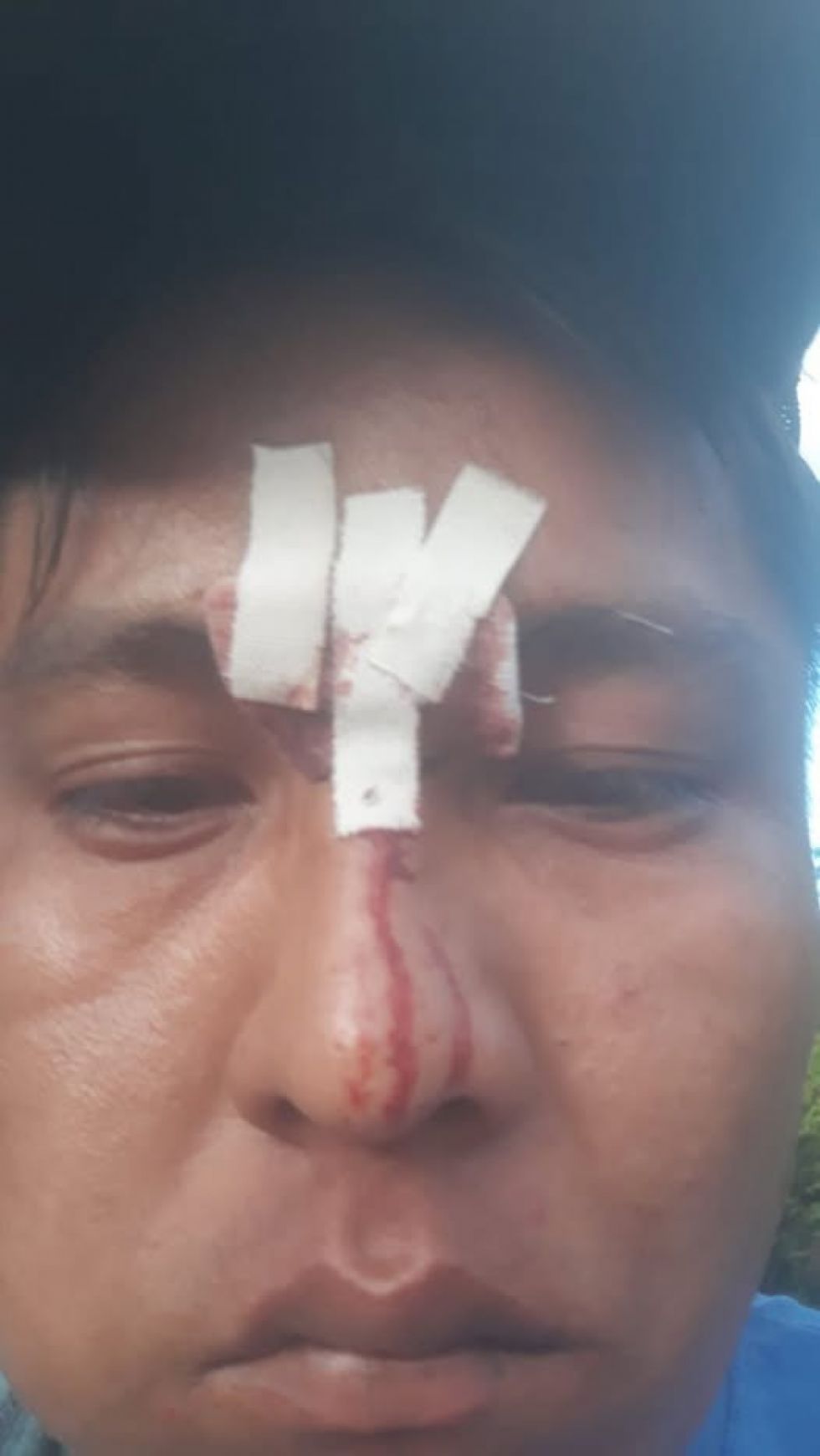 Yacuiba: enfrentamientos entre comunarios y Policía dejan heridos y destrozos (Video)