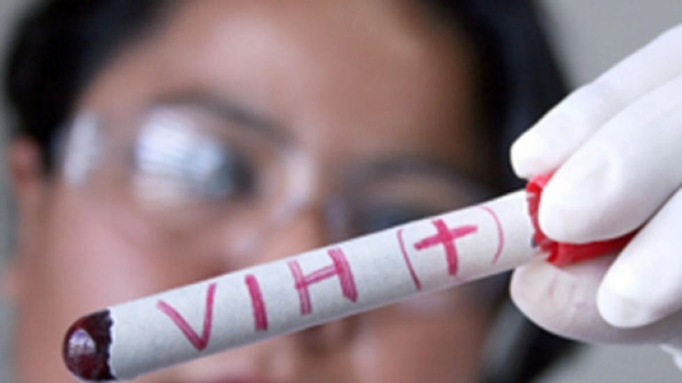 Tarija: Analizan declarar alerta por aumento de casos de VIH 