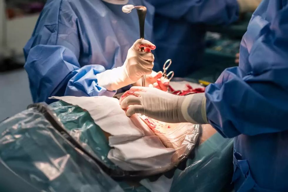 Las negligencias médicas durante el parto siguen invisibilizadas en Bolivia