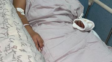 Procesan a sujeto que prendió fuego a su cuñada