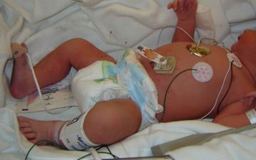 Confirman el cuarto fallecimiento por coqueluche en Santa Cruz