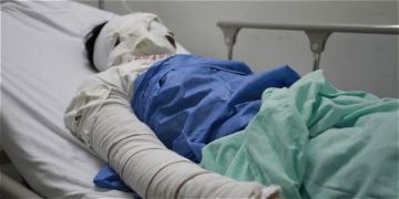Muere el hombre que fue golpeado y quemado en Shinahota tras ser acusado de robo