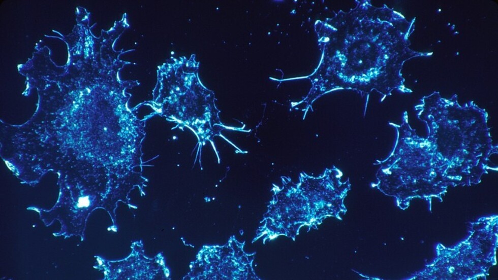 Descubren qué elemento puede ayudar a prevenir y combatir el cáncer