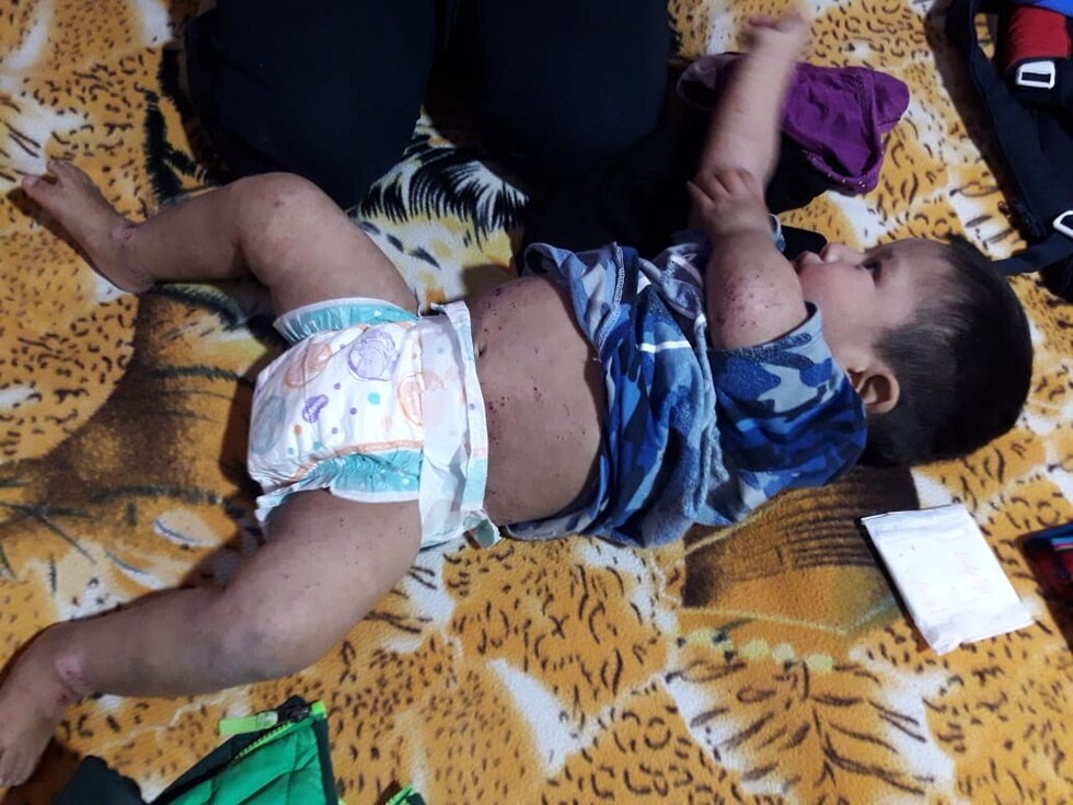 Organizan kermesse solidaria para Abraham, un niño tarijeño con síndrome de Wiskott-Aldrich