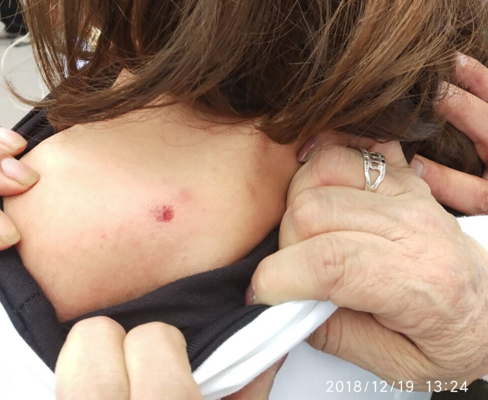 Médicos denuncian ataques con balines a los marchistas