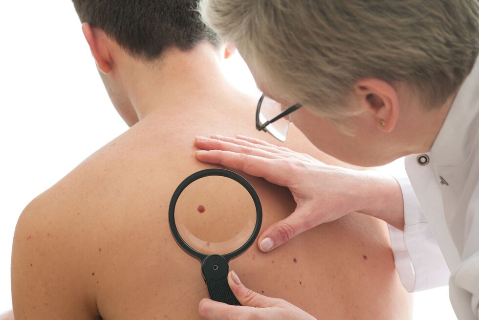 ¿Cuándo ir al dermatólogo?