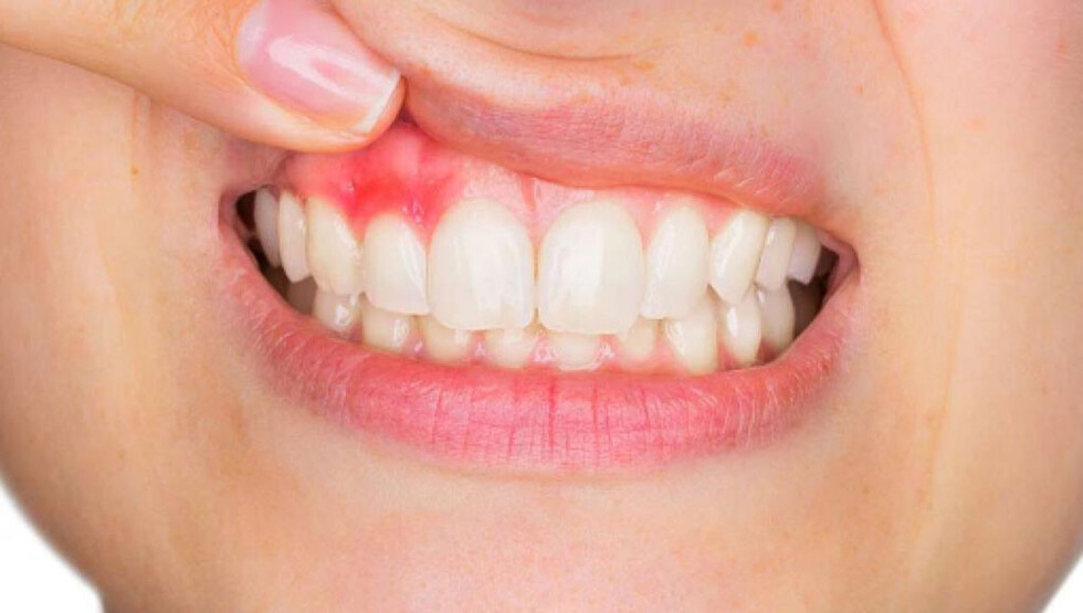 Una buena salud gingival