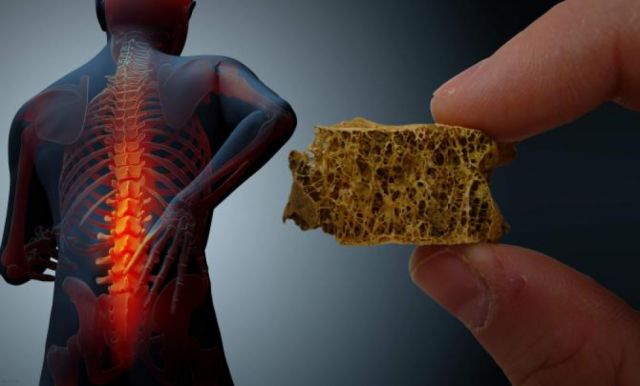 La oxitocina puede prevenir el surgimiento de la osteoporosis