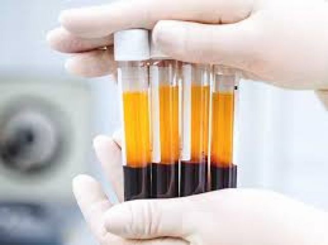 Estudio preliminar en España sugiere que el plasma reduce la mortalidad por covid