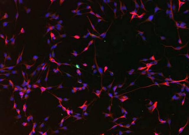 Manzanas para reforzar el cerebro