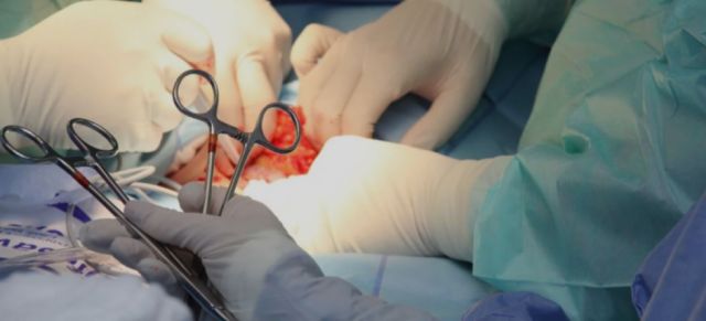Trasplantan por primera vez dos riñones de cerdo modificado genéticamente a una persona