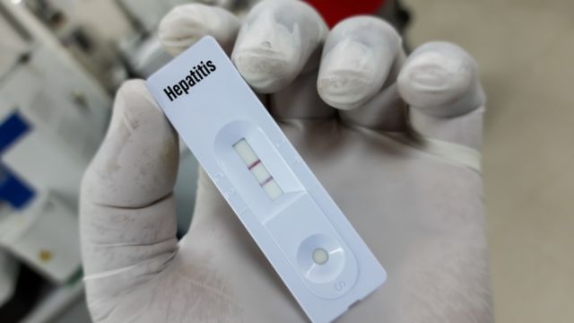Reportan primer caso  de hepatitis aguda grave de origen desconocido en Argentina