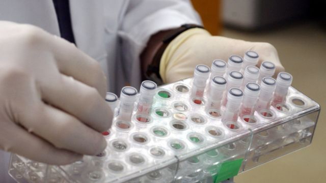 Ocho casos sospechosos de viruela del mono en España ponen en alerta a las autoridades sanitarias