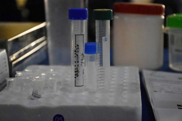 Salud descarta escalada de casos de viruela del mono 