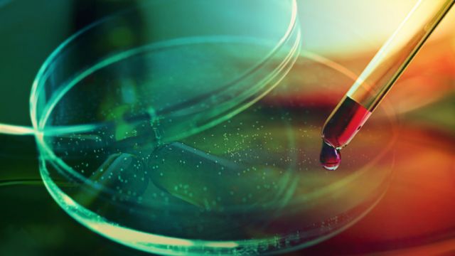 Confirman la primera coinfección por VIH, viruela del mono y Covid-19
