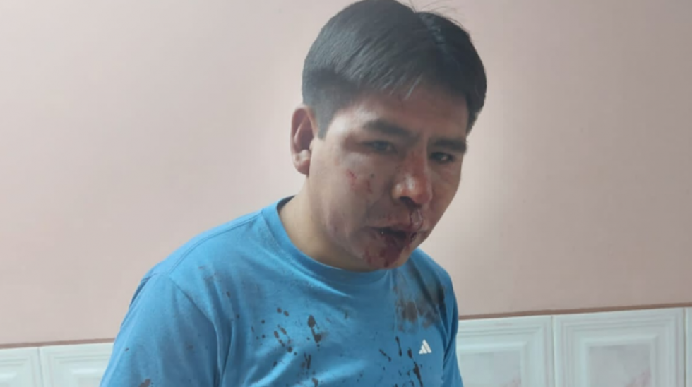 Arrestan a dirigentes del MAS por golpiza al presidente de la Brigada Parlamenaria de Potosí