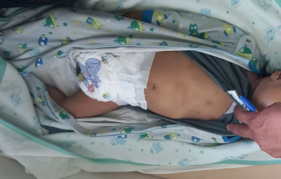 Infanticidio: Bebé murió con síndrome de niño sacudido