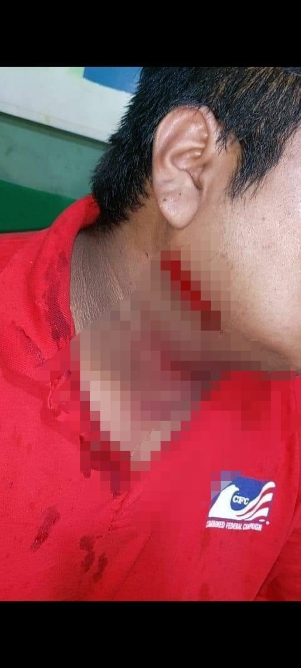 Dos sujetos intentaron “cogotear” a un taxista en Tarija