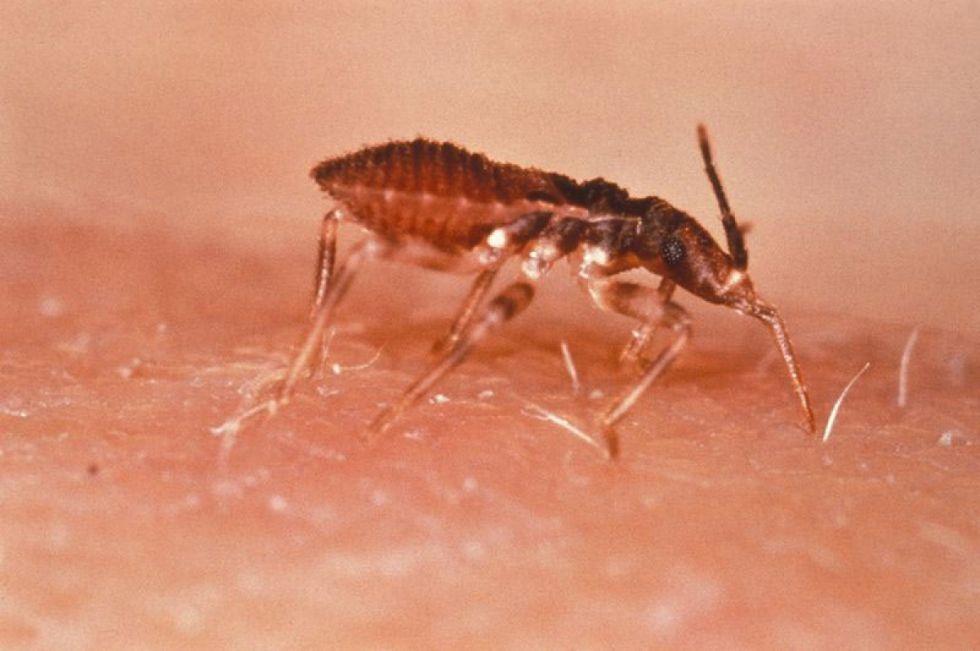 OPS alerta baja detección de personas con Chagas