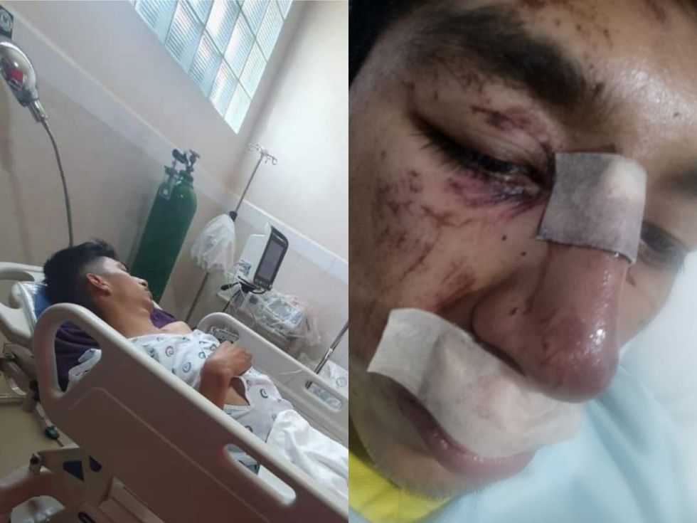 Ciclistas tarijeños piden ayuda tras aparatoso accidente en Cochabamba