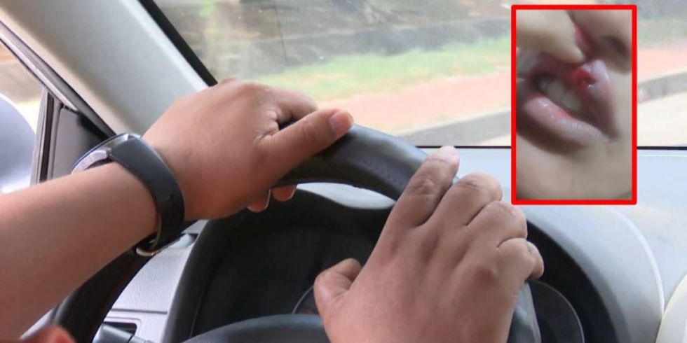 Un taxista le rompió el labio a su pasajera por 5 bolivianos 