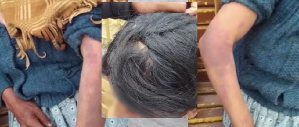 Oruro: Adolescente golpeó a su mamá con un palo por servirle comida fría