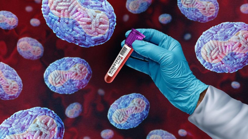 Mpox: OMS declara emergencia sanitaria global