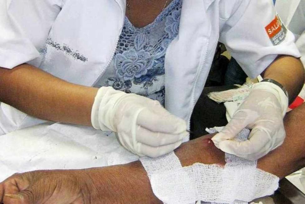 Bolivia registra 482 casos de lepra en 10 años