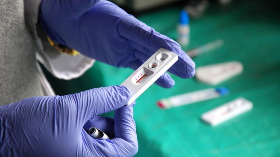 Cerdet refuerza capacitación sobre la prevención del VIH