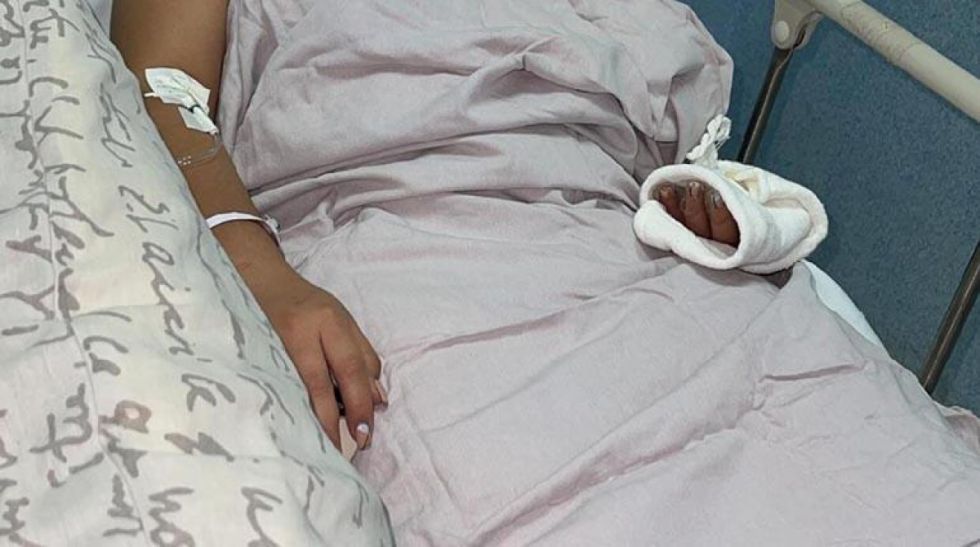 Procesan a sujeto que prendió fuego a su cuñada