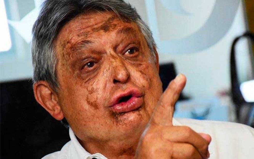 Jaime Paz dice que sin pensión de expresidente tendría que pedir limosna ‘¿con qué vivo?’