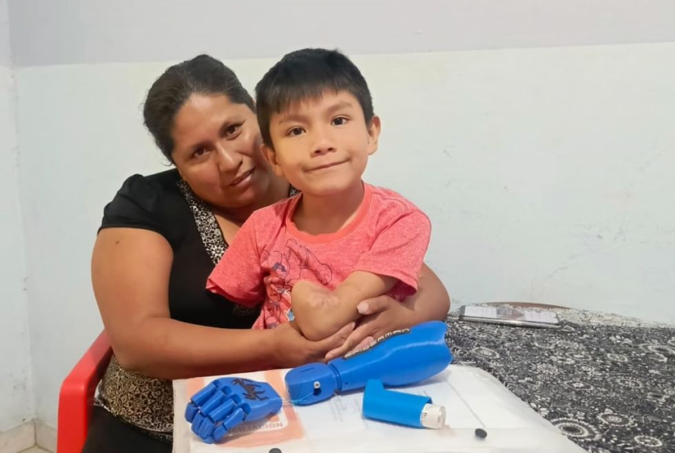 Ángel Valentín, el niño que perdió sus brazos, pero no sus sueños 
