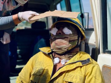 Conjuntivitis y cefaleas, las dolencias que deja el fuego 