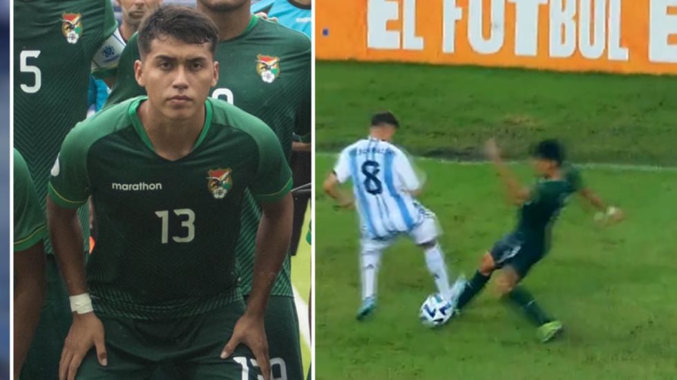 Parte médico del villamontino Altamirano luego la brutal falta que recibió ante Argentina
