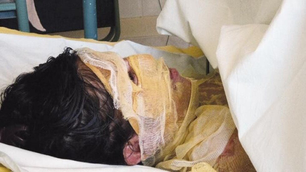Mujeres prendieron fuego a un joven discapacitado