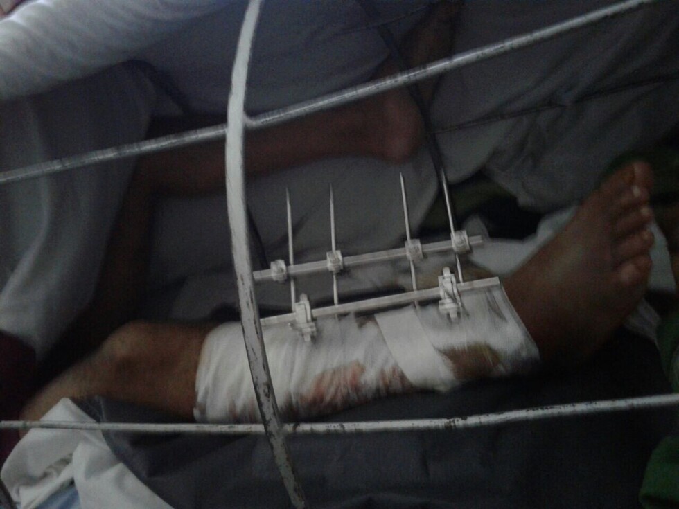 Escapó de su concubina apuñalado en el brazo