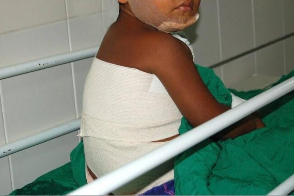 Un niño de 13 años ató y  quemó a su sobrino de 3
