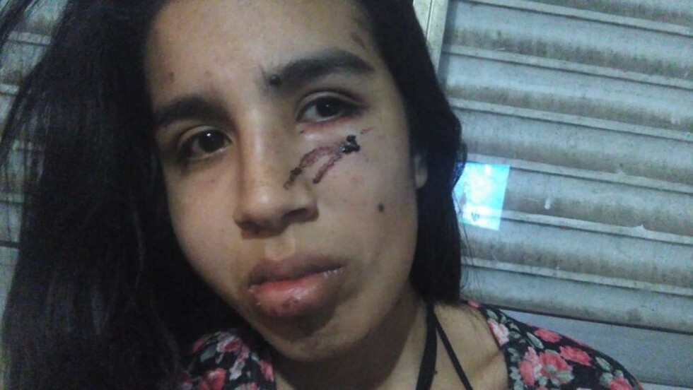 Una abuela se enfrentó a patadas a un ladrón